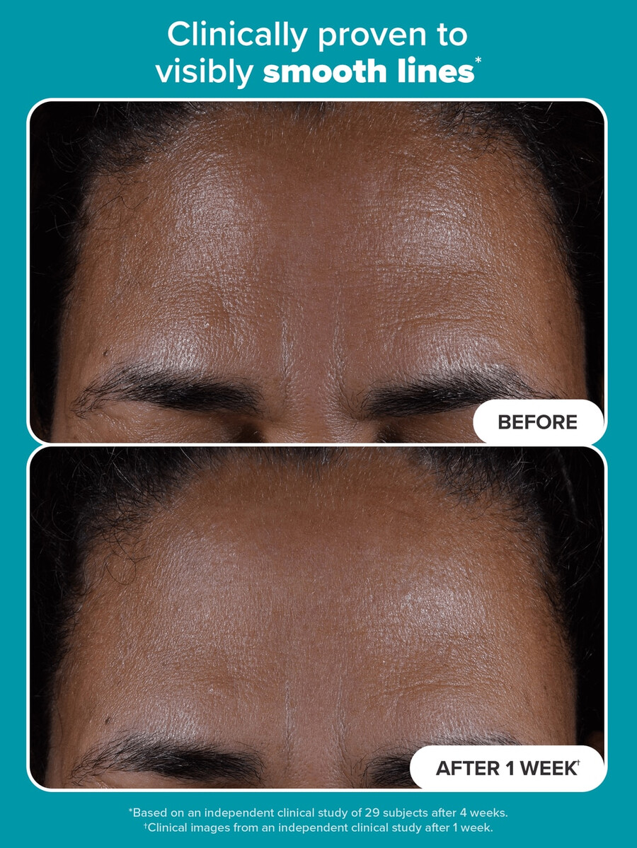 hudperfektering 2 bha flytande exfoliering