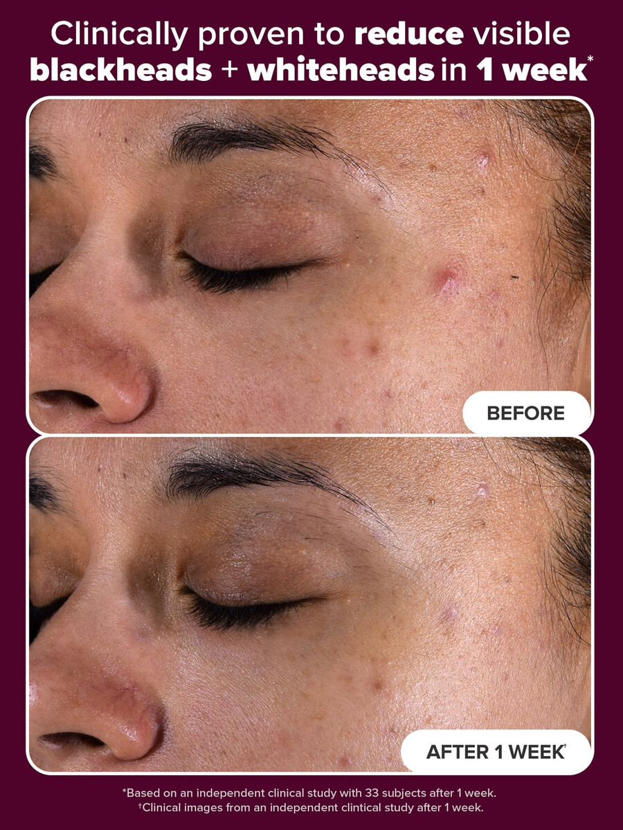 holiday edition 2 bha exfolierande toner