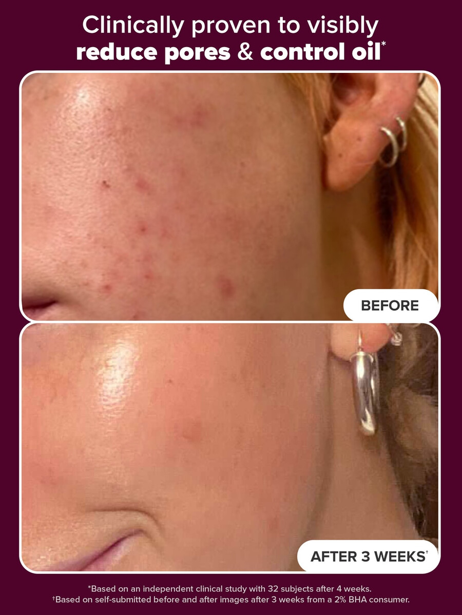 holiday edition 2 bha exfolierande toner