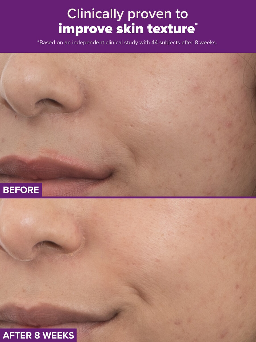 clinical pro retinaldehyd dual-retinoidbehandling