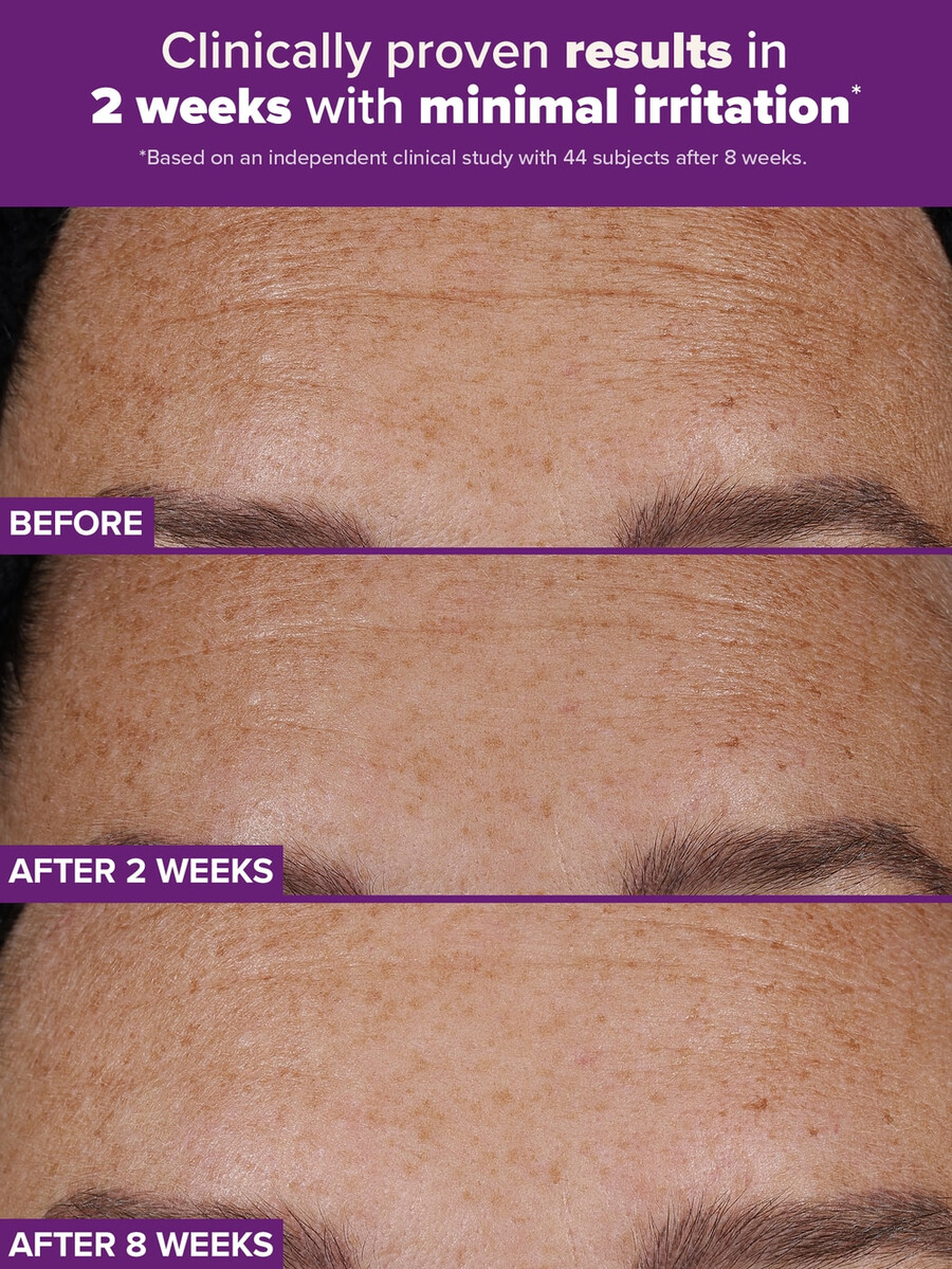 clinical pro retinaldehyd dual-retinoidbehandling
