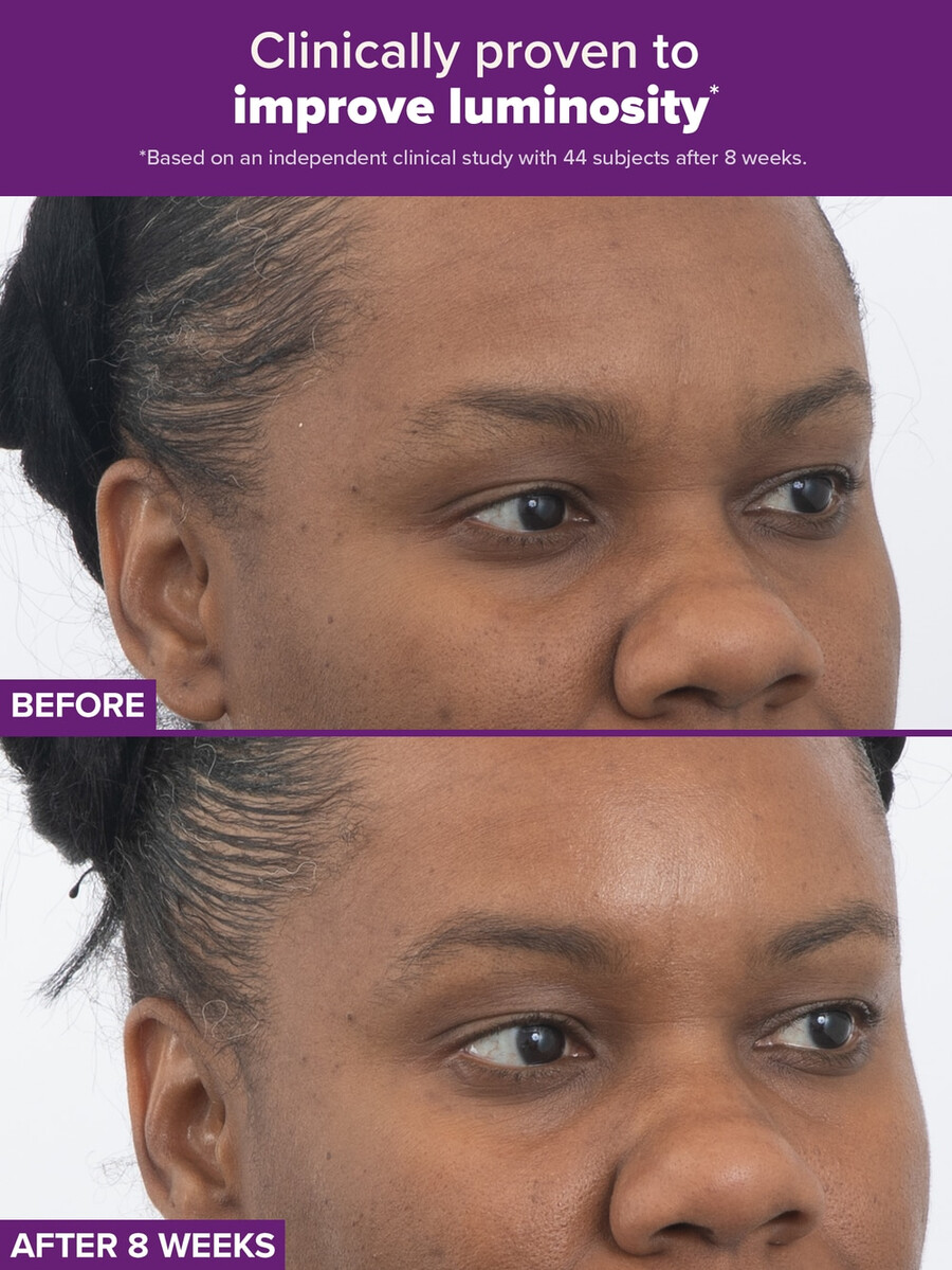 clinical pro retinaldehyd dual-retinoidbehandling